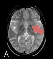 MRI-CoPANa-3